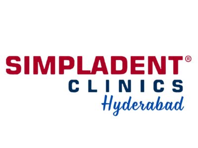 Full Mouth Dental Implant in Hyderabad