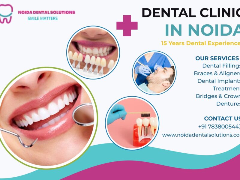 Expert Teeth Aligners Treatment in Noida for a Confident Smile