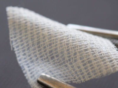 Acesso Biologics – Amniotic Membrane Graft for Wounds