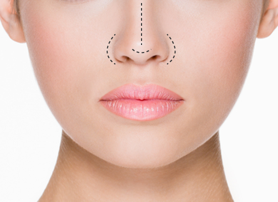 Correcting Nose Asymmetry with a Non-Surgical Nose Job Explained