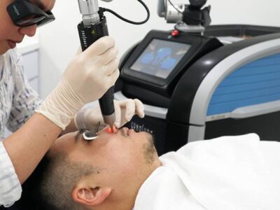 Can Picosure Laser Treatment Help With Scars?