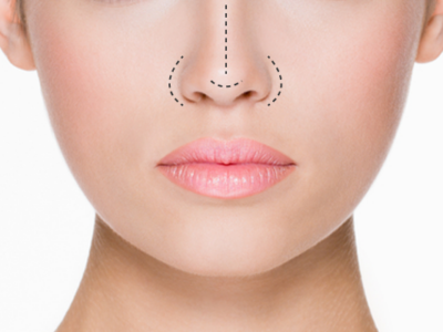 Correcting Nose Asymmetry with a Non-Surgical Nose Job Explained